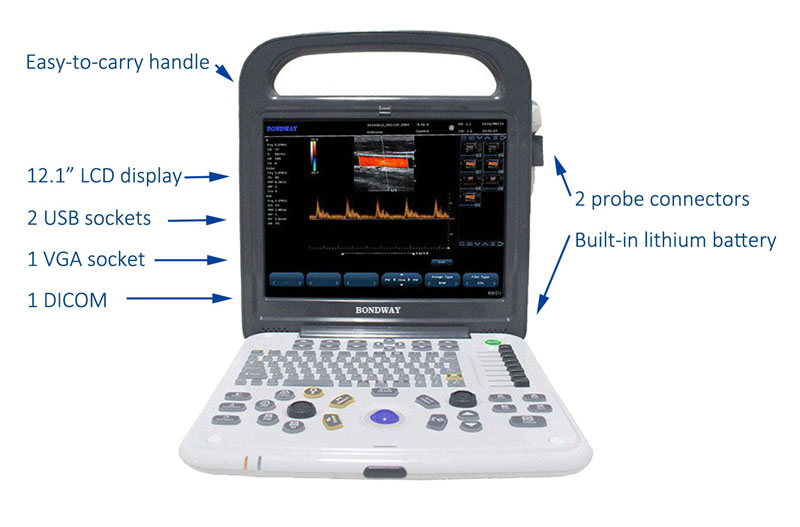Color Doppler diagnostic ultrasound system Bondway ES240